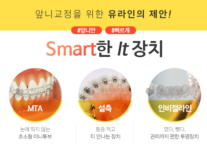 부분교정기간 열광하는이유 알겠네 관련 이미지 4
