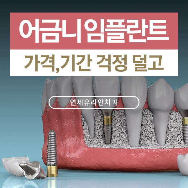 어금니임플란트가격에 대한 걱정되는마음을 관련 이미지 1