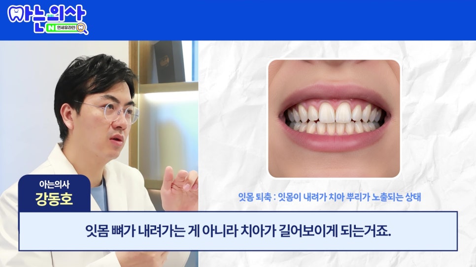 관악구 신림동치과 - 치아가 길어보이는 이유 관련 이미지 3