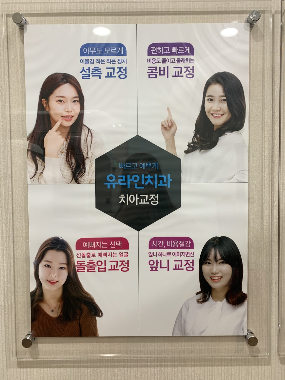토끼앞니교정 부분으로 드는 비용은 관련 이미지 3