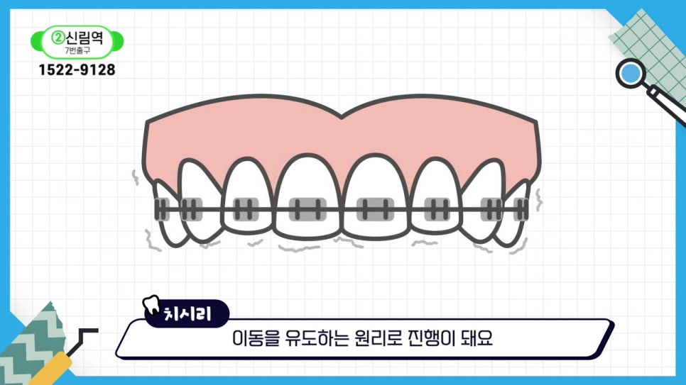 관악구치아교정, 빨리 끝내고 싶어? 관련 이미지 6