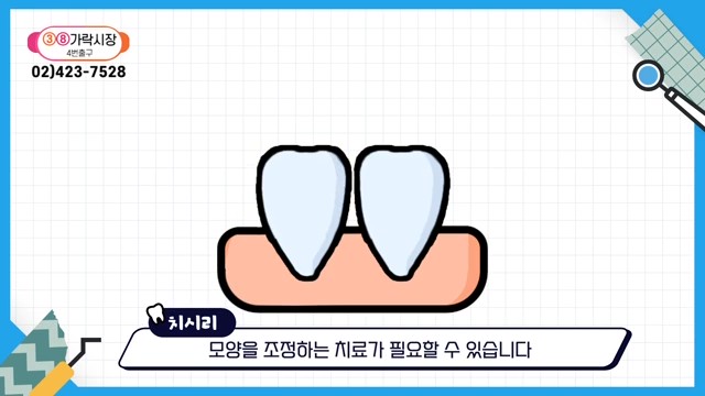 Can the Gaps Between Your Teeth That Make You Look Older Be Fixed? image 18
