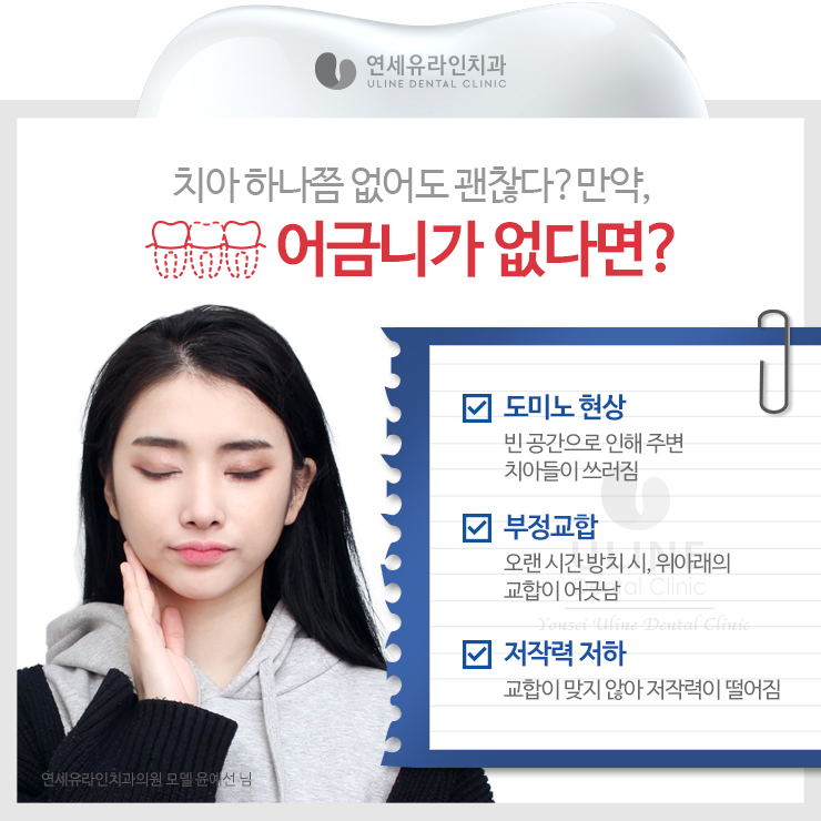관악구치과 어금니임플란트가격대비 끝내줘 관련 이미지 1