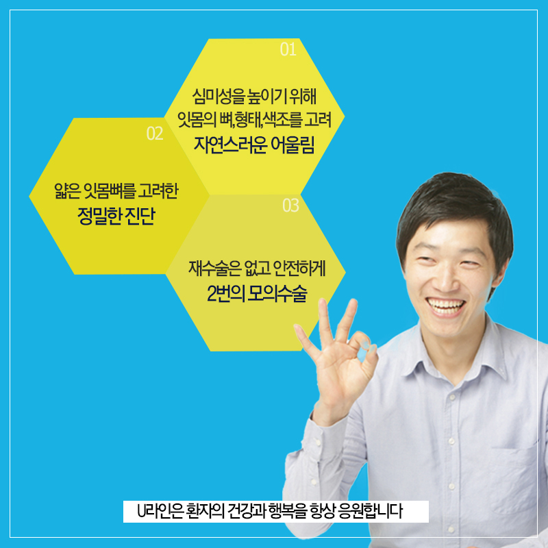 앞니임플란트가격 결과 모두 좋아 관련 이미지 9