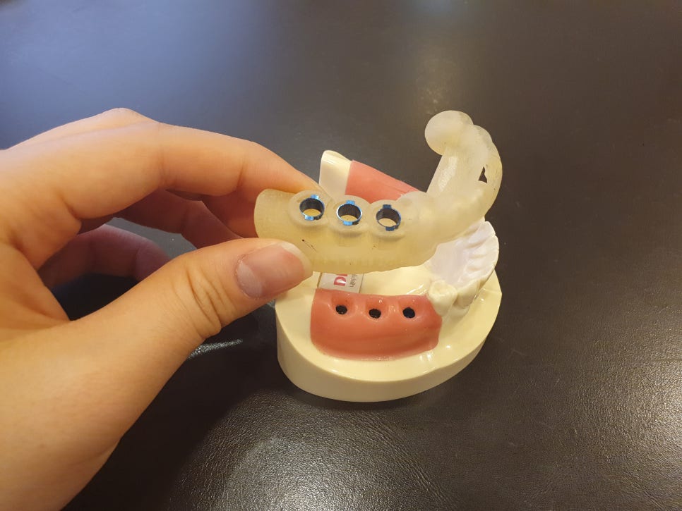 앞니임플란트비용 어금니보다 왜비싸지 관련 이미지 4