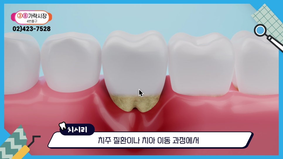 Gum Health During Orthodontic Treatment in Sillim-dong.. image 21