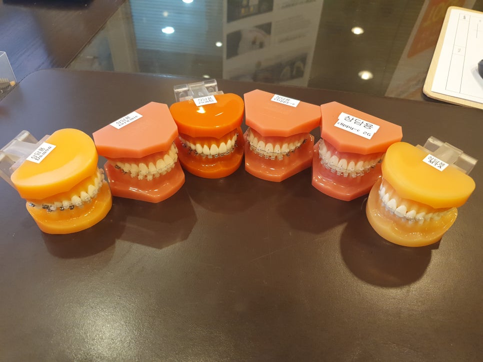 치아부분교정 가격 이제부터가 시작이야 관련 이미지 5