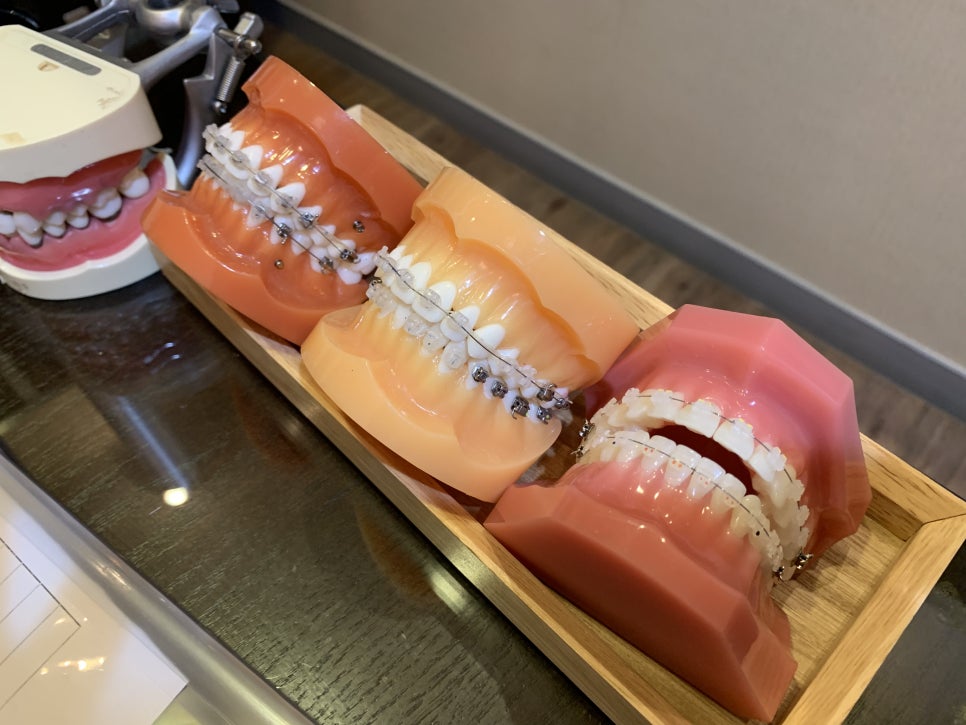 강남역치과 정작 중요한것은 바로 이것 관련 이미지 3