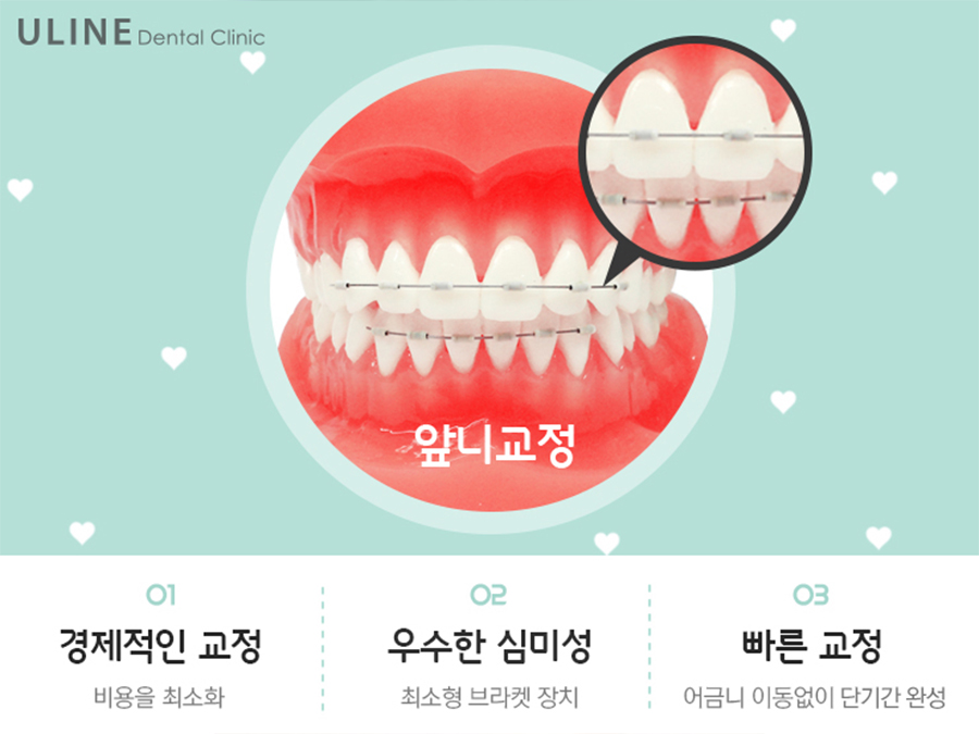 학동역치과 후회없이 관련 이미지 6