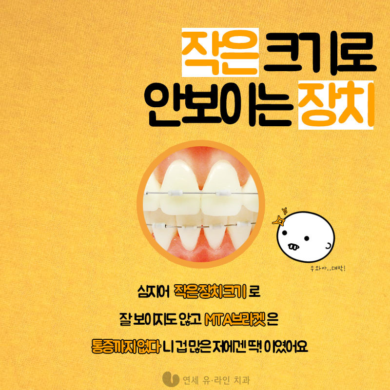 앞니부분교정후기 듣고 시작했어요! 관련 이미지 6