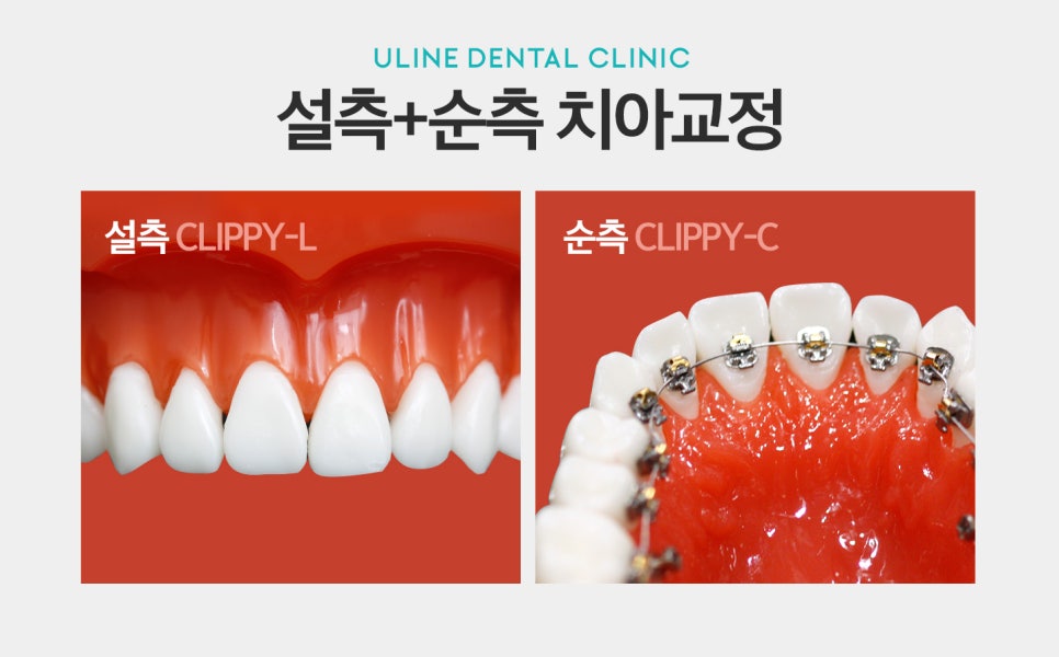 신대방역치과 두가지 모두를 한번에 누리자! 관련 이미지 2
