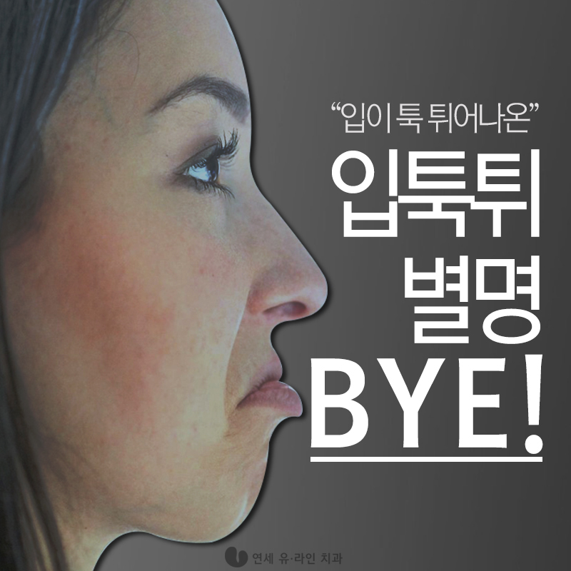 클리피씨교정후기 찜꽁했어♡ 관련 이미지 1