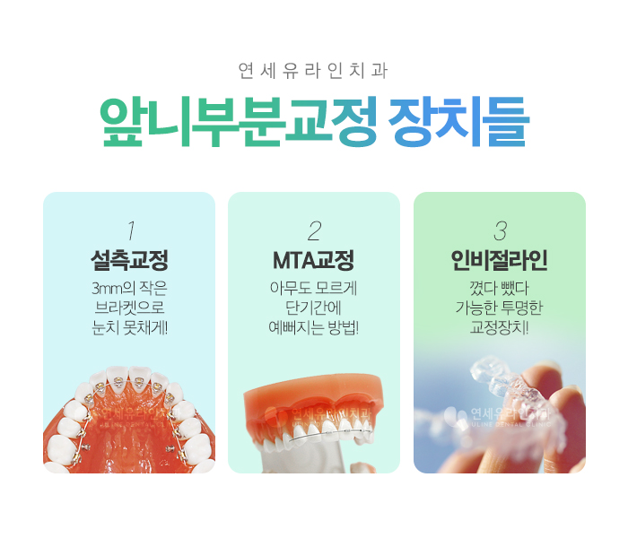 동작구치과 쉽고 빠르게 앞니만 개선하기 관련 이미지 4
