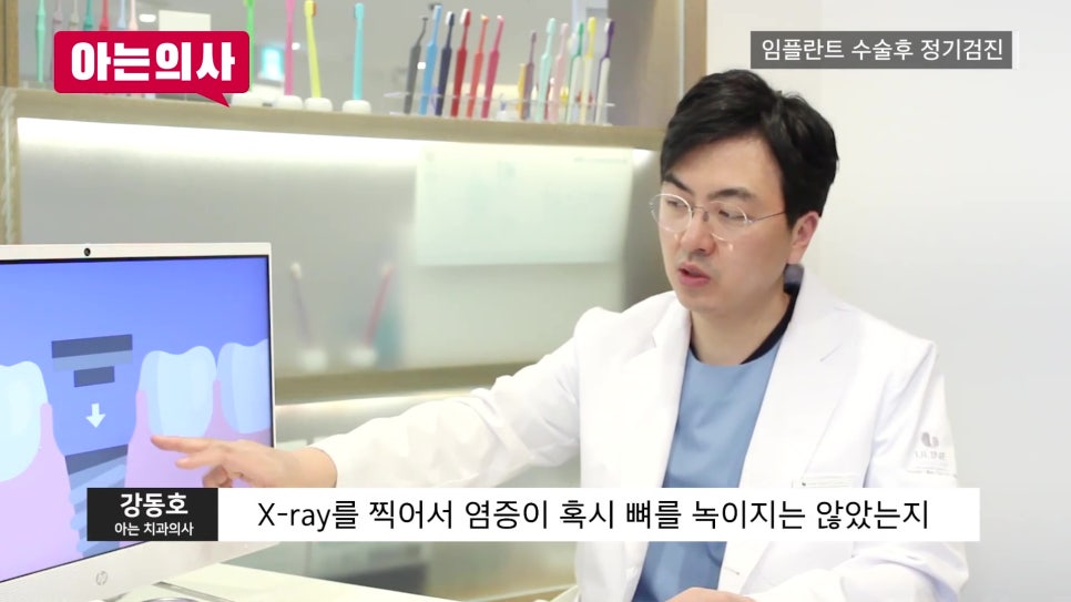신림역임플란트 후, 정기검진 안 하면 관련 이미지 20