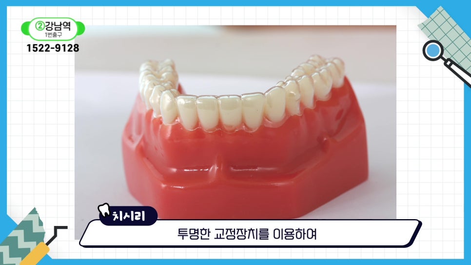 신림동치과 - 안 보이는 투명교정의 모든것 관련 이미지 10