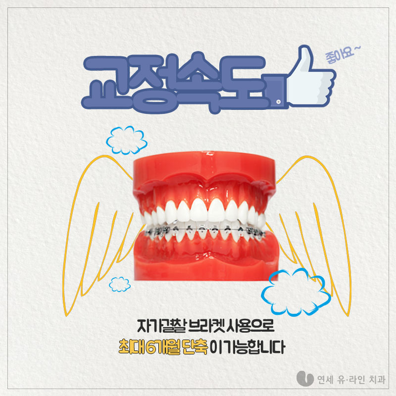 서울대입구역치과 교정장치 고민을 한번에! 관련 이미지 4