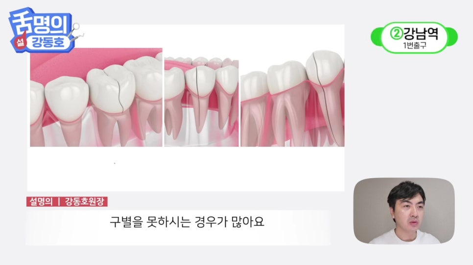 역삼역야간진료치과, 씹을 때마다 아파? 관련 이미지 4