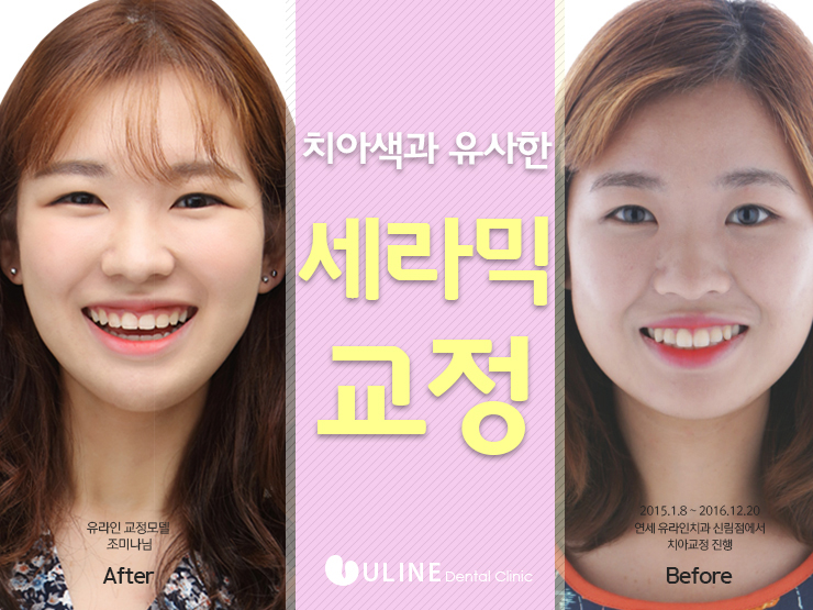 사당치과 예쁜미소 뿜뿜 관련 이미지 6