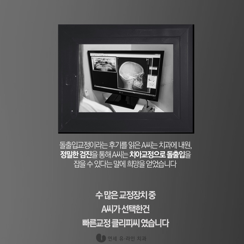 클리피씨교정후기 찜꽁했어♡ 관련 이미지 3