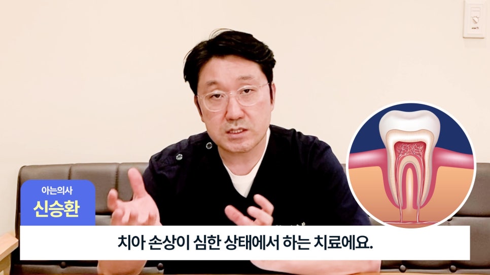 송파구신경치료 후 크라운, 꼭 해야 할까? 관련 이미지 4