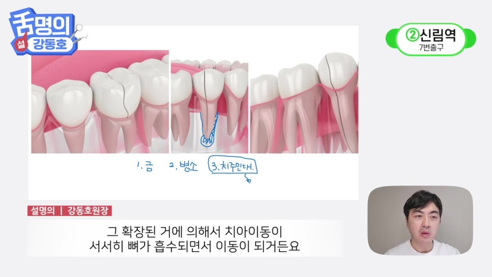 역삼역야간진료치과, 씹을 때마다 아파? 관련 이미지 24