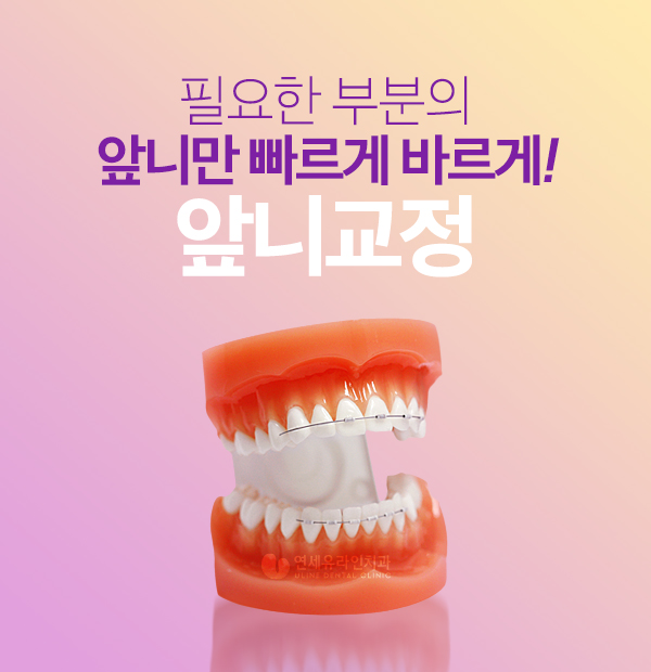 강남역교정치과 변화를 주고 싶은 지금 관련 이미지 1