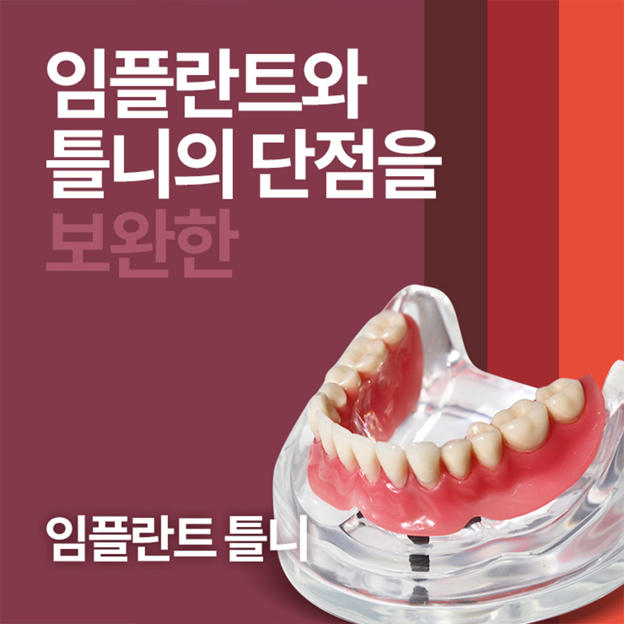임플란트틀니비용 기쁨을 만나보자 관련 이미지 1