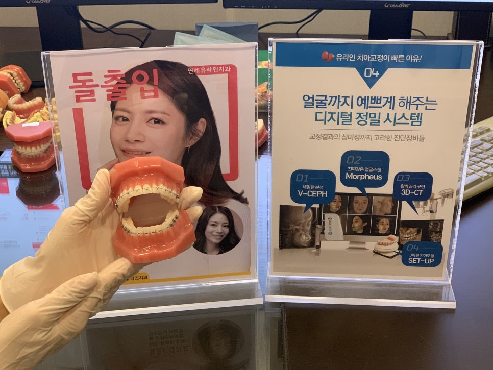 신림역치과 달라진위치 그로인한 편함 관련 이미지 5