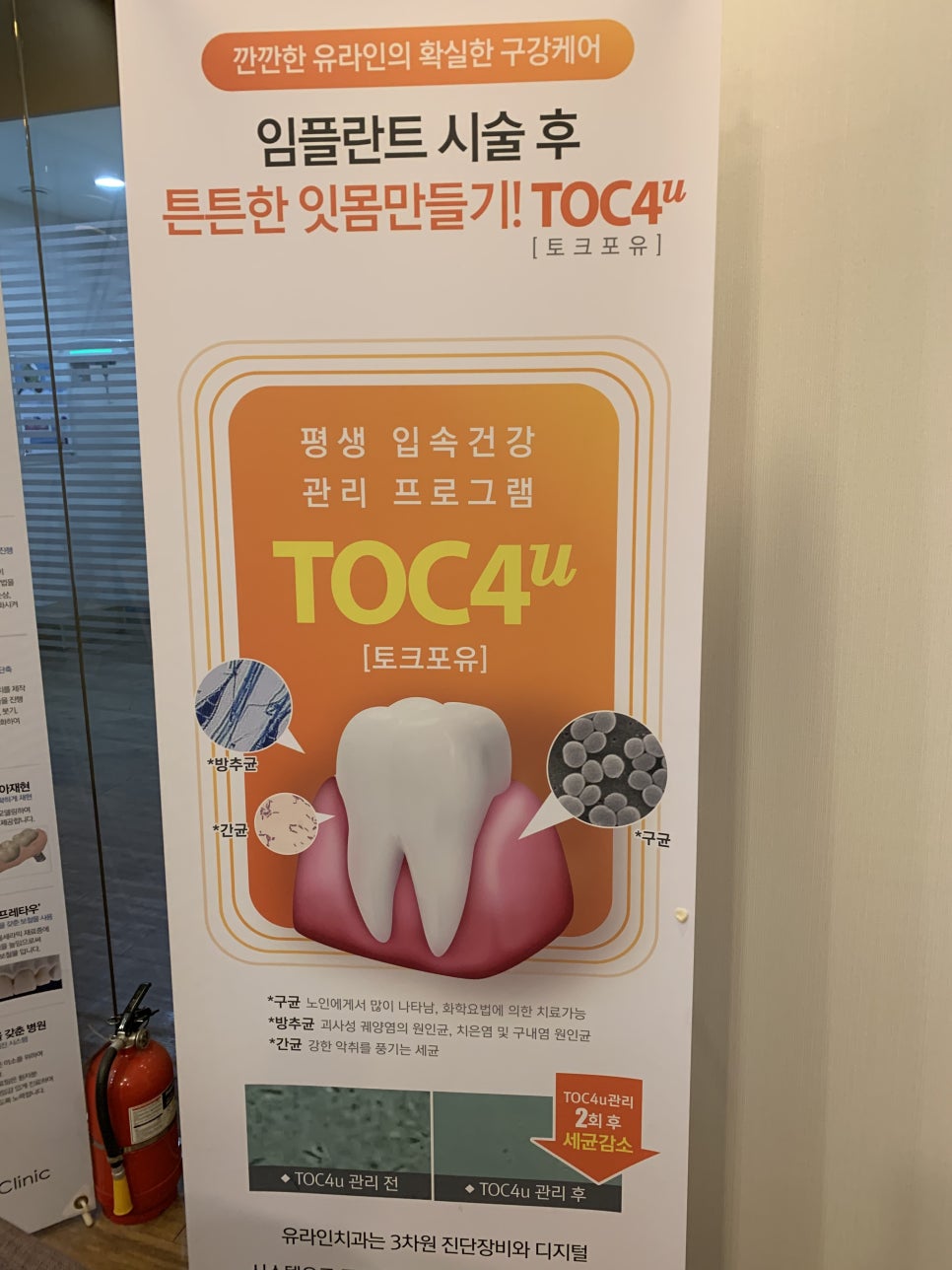 어금니임플란트잘하는곳 후회하지않게 관련 이미지 5