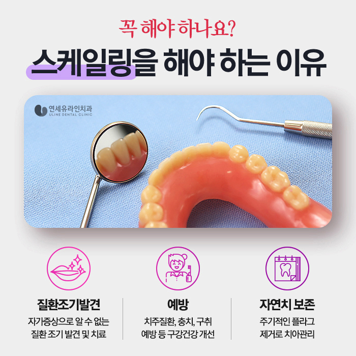 강남역 스케일링 일년에 한두번은 치과에서 관련 이미지 2