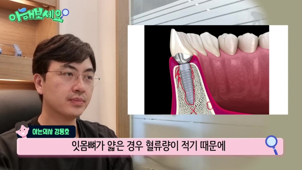 역삼역임플란트치과, 젊은층도 실패를? 관련 이미지 20