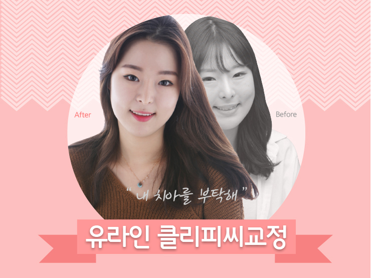 클리피씨교정기간 빠르게 원츄원츄 관련 이미지 1