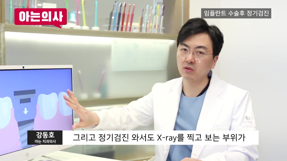 신림역임플란트 후, 정기검진 안 하면 관련 이미지 19