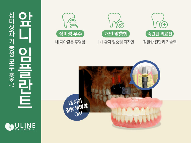 앞니임플란트잘하는곳 정말 중요하죠 관련 이미지 4