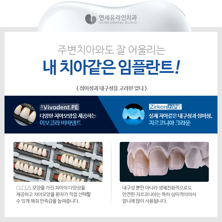 앞니임플란트가격 좋은예후를 기대하러 관련 이미지 8