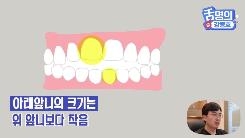 신림동치과, 브릿지치료 치아삭제 부담된다면? 관련 이미지 3