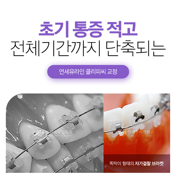클리피씨교정기간 예상한 시간 보다 빨리! 관련 이미지 3