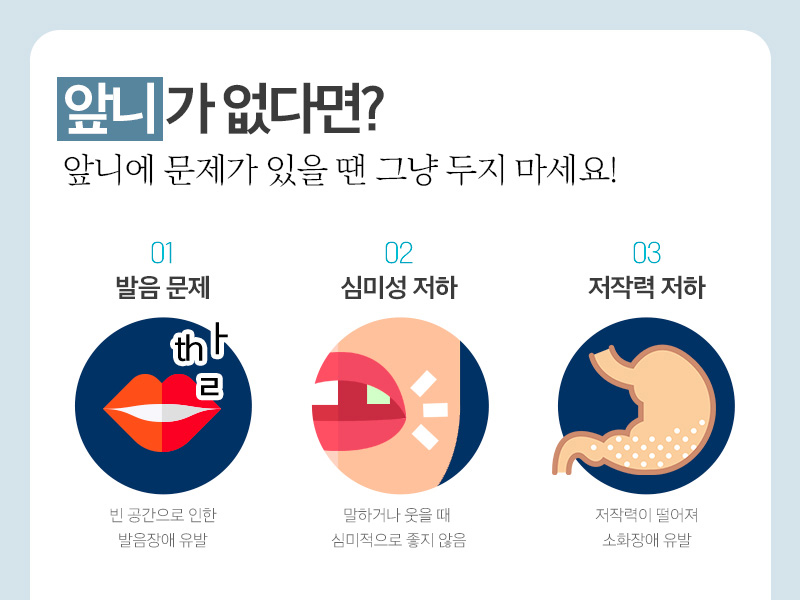 앞니임플란트가격 시작부터 마음좋게 관련 이미지 2