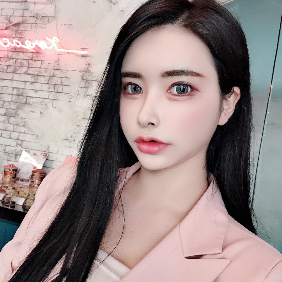 치아교정기 종류 나는 두가지를 함께하지 관련 이미지 1