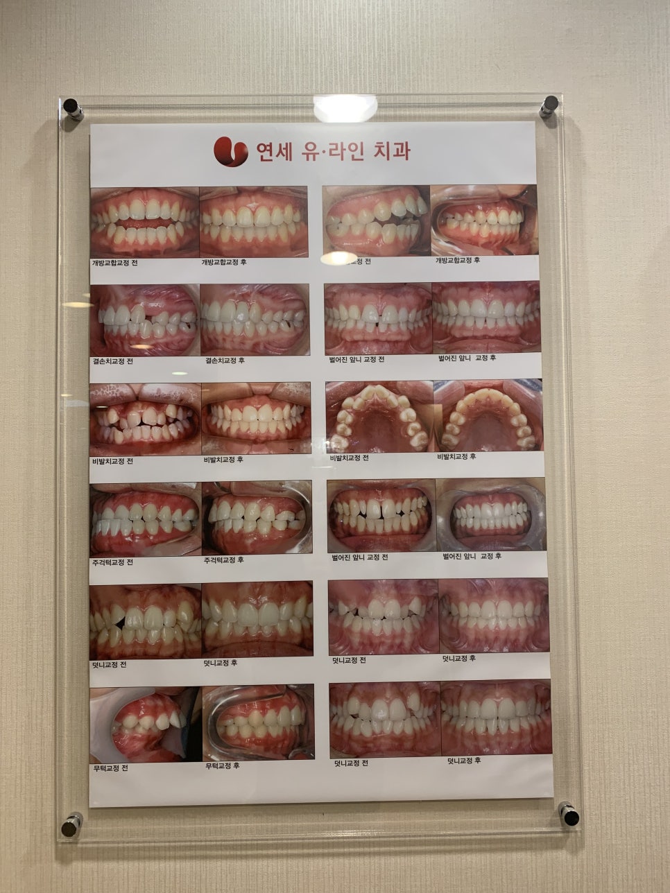 클리피씨교정비용 내 친구도 탐내 관련 이미지 2