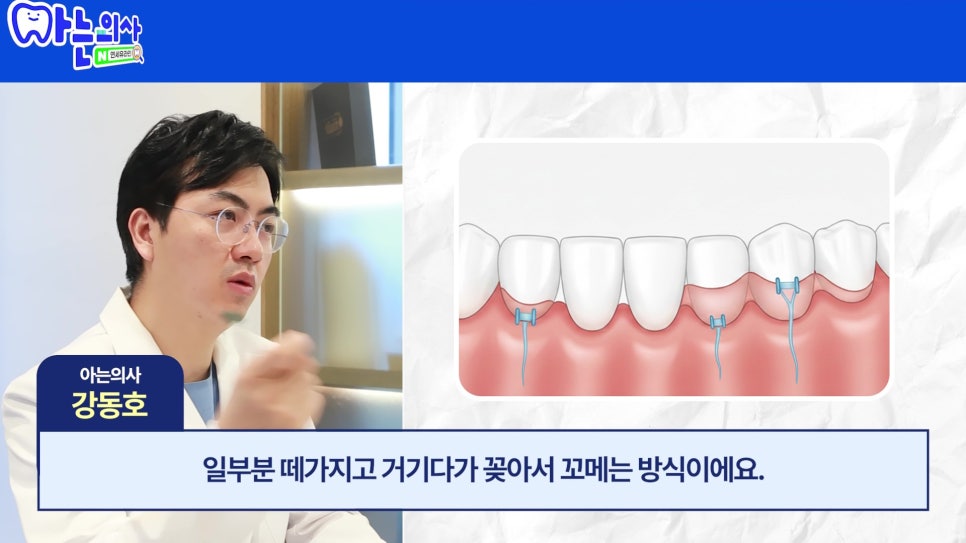관악구 신림동치과 - 치아가 길어보이는 이유 관련 이미지 26
