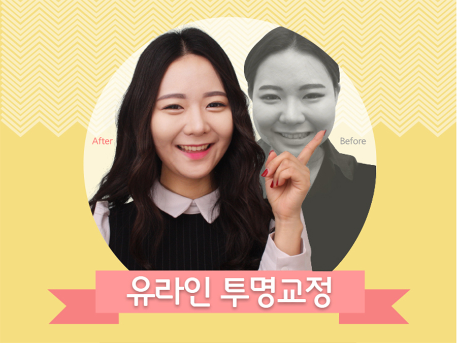 신림역치과 교정은 역시 관련 이미지 1