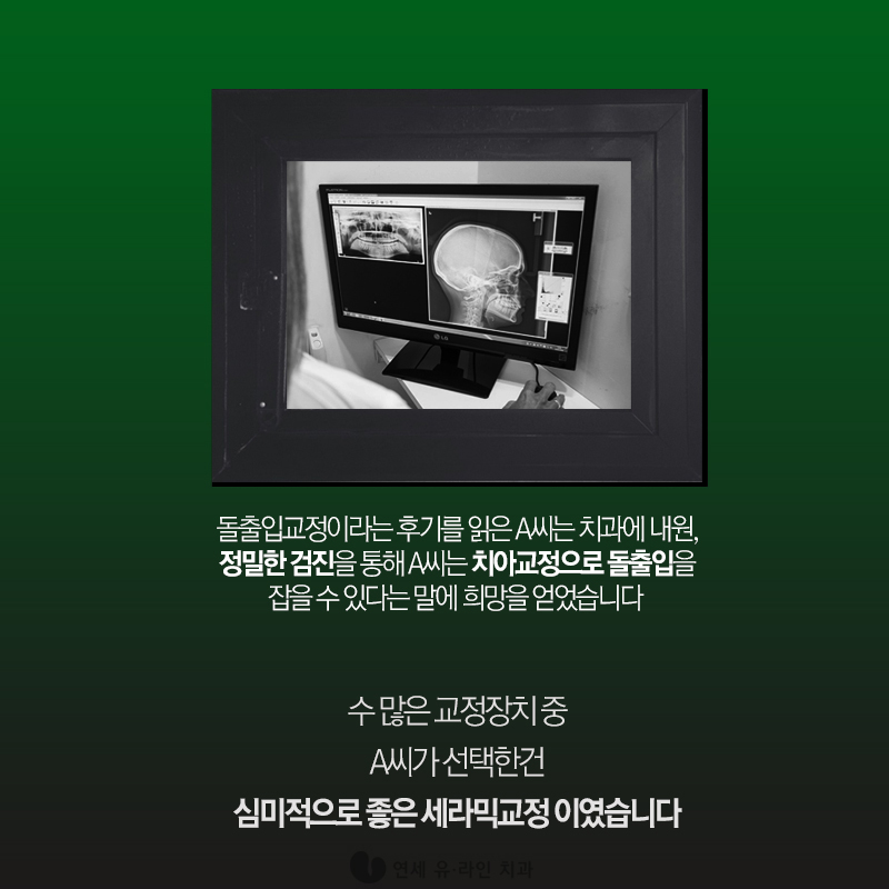 세라믹교정가격 이러니 인기만점 관련 이미지 3