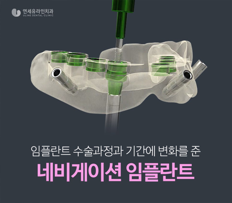 송파구치과 신중한 선택을 위해 관련 이미지 4