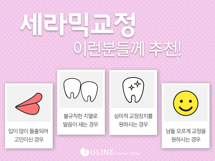 세라믹교정후기 들어보셨어요!? 관련 이미지 2