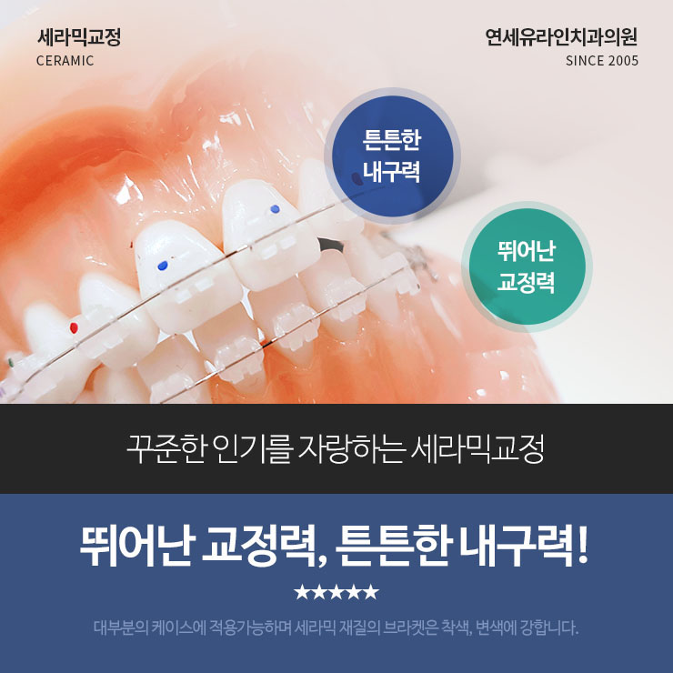 세라믹교정후기 오늘부터 시작할래 관련 이미지 5