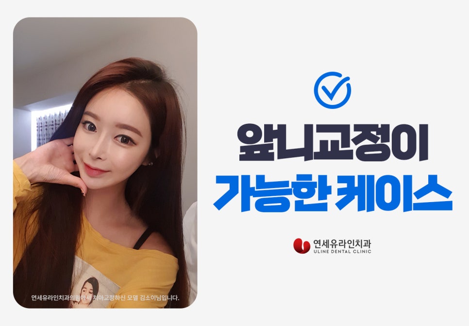 앞니부분교정기간 눈 깜짝 할 사이에! 관련 이미지 6