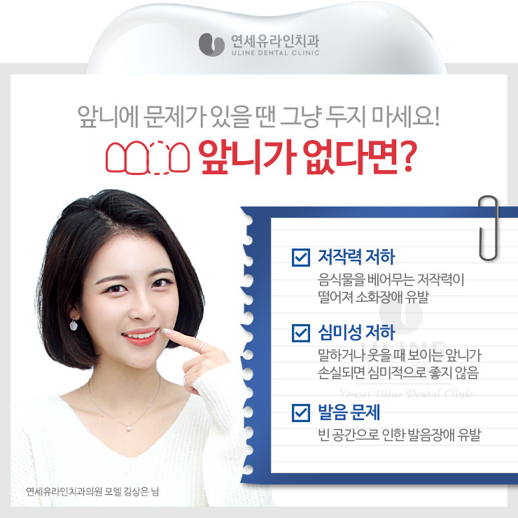 앞니임플란트가격 좋은예후를 기대하러 관련 이미지 2