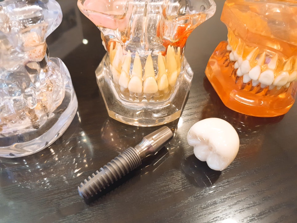 가락동치과 다시 회복되기를 바라며 관련 이미지 2