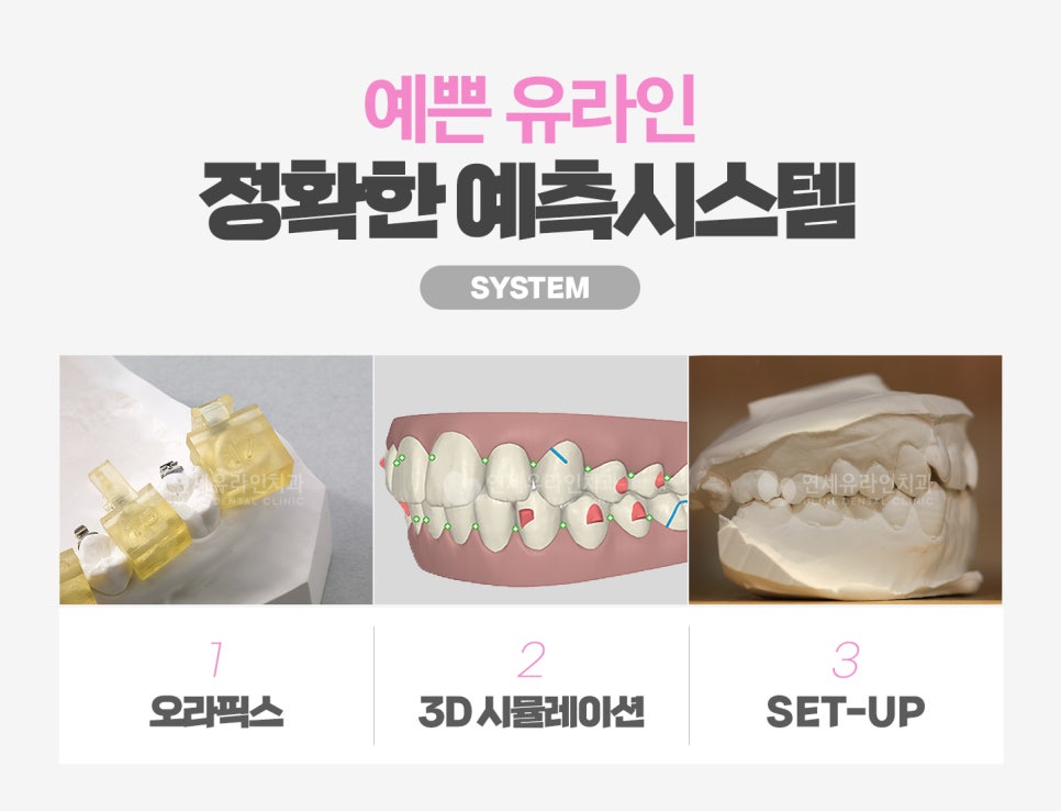 앞니부분교정가격 서둘러 진행하고싶어요 관련 이미지 6